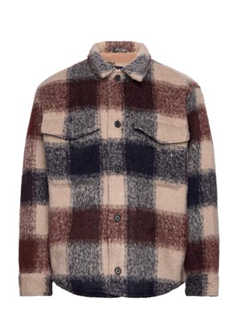 Anf Mens Outerwear Ohut Takki Monivärinen/Kuvioitu Abercrombie & Fitch