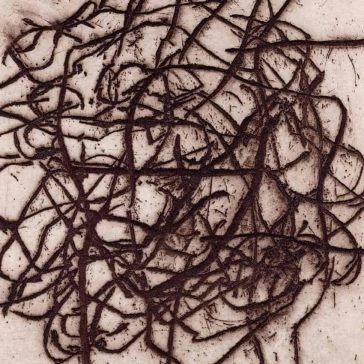 Arrhythmian Leimer K. And Barecc