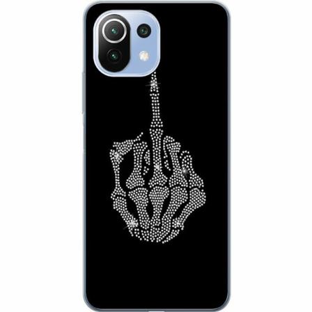 Xiaomi 11 Lite 5g Ne Genomskinligt Skal Fuck You Bling