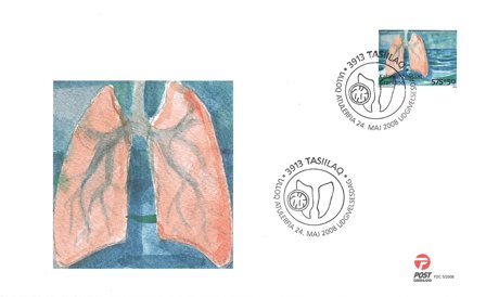 Grønland - Anti-Tuberkulose - Førstedagskuvert