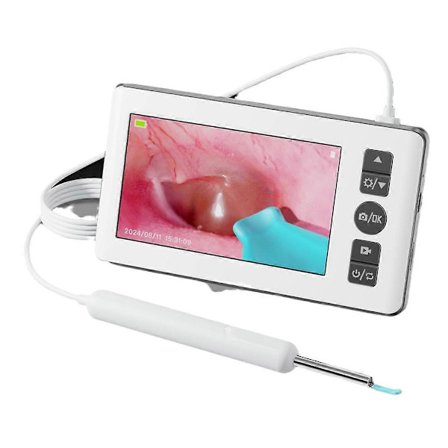 Digitalt otoskop med 3,5 mm øreskopkamera med 6 lys 1080P 4,3 TOMMER IPS ørevoksfjerningsværktøj