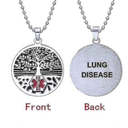 Träd Av Alert Hängsmycke Halsband