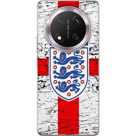 Yhteensopiva Puhelinkuori Honor Honor Magic7 Lite England emblem