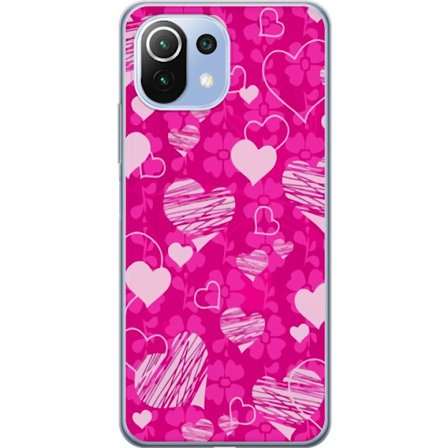 Yhteensopiva Puhelinkuori Xiaomi Xiaomi Mi 11 Lite PopSydänKuviointi