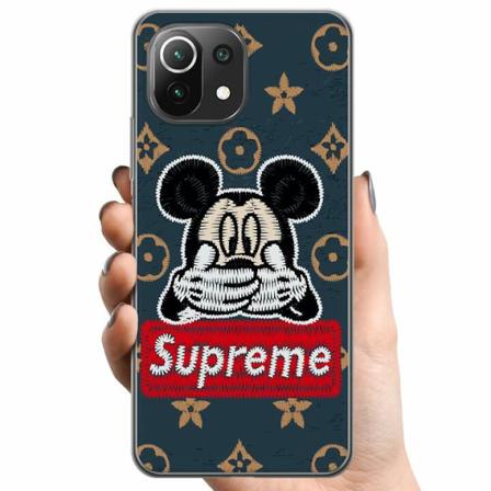 Xiaomi Mi 11 Lite Tpu Mobilskal Happy Sup...