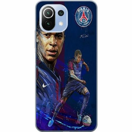 Xiaomi 11 Lite 5g Ne Skal / Mobilskal - Mbappe
