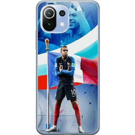 Xiaomi Mi 11 Lite Skal / Mobilskal - Kylian Mbappé