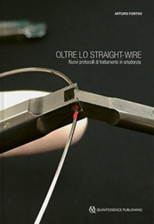 Oltre lo straight-wire. Nuovi protocolli di trattamento in ortodonzia. Con immagini e video Arturo Fortini