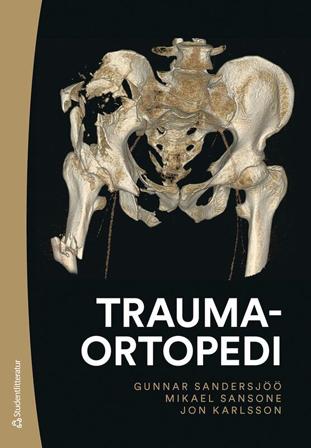 Traumaortopedi, ISBN: 9789144175287