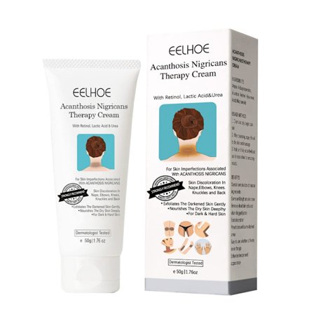 Anti-Acanthosis Kräm Stark Privat Del Armhåla Blekande Lotion Hud Mörka Fläckar Kroppsområde Snabbt Verkande Blekande Kräm