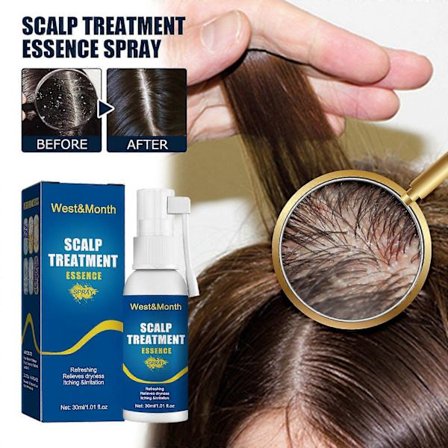 Scalp Treatment Essence Spray