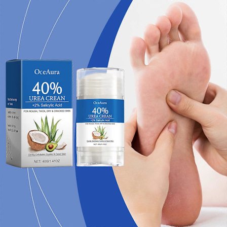Urea krem, fotkrem med urea, 40 % urea krem med 2 % salisylsyre, krem for tørre og sprukne føtter, aloe vera, fukter, fjerner hard hud og