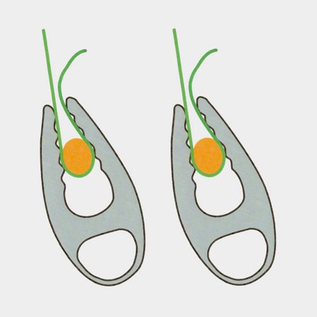 Uchycovací prvky pro všechny typy plachty UltraGlozz Strong Grip, 2-pack