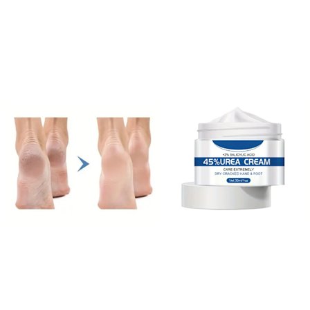 Urea Creme 45% Maksimal Styrke Callus Fjerner Fugter & Blødgør Tørre Revner