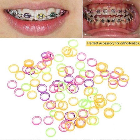 100 st/set Professionella Elastiska Tand Gummiband Oral Ortodonti Verktyg 1/8(3.16mm)