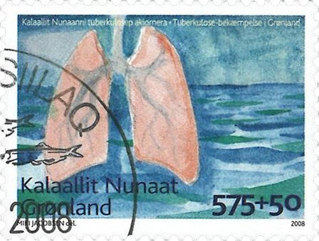 Grønland - Anti-Tuberkulose - Stemplet frimærke