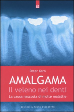Amalgama. Il veleno nei denti. La causa nascosta di molte malattie Peter Kern