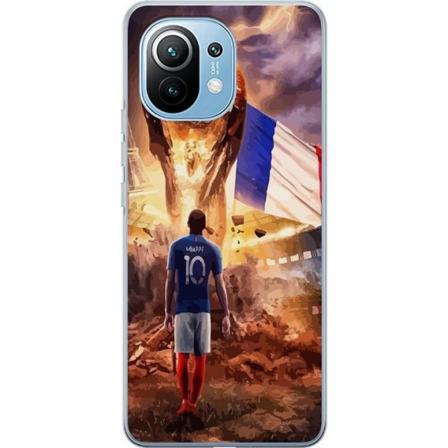 Xiaomi Mi 11 Skal / Mobilskal - Kylian Mbappé