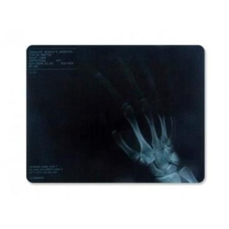 handröntgen datormatta