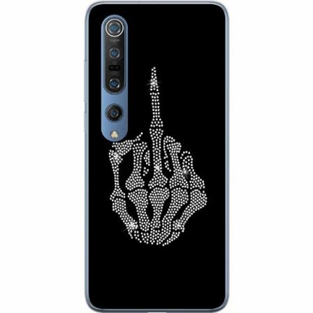 Xiaomi Mi 10 Pro 5g Mjukt Skal - Fuck You Bling