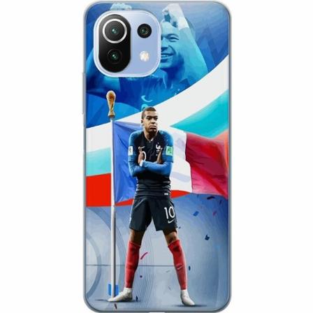 Xiaomi 11 Lite 5g Ne Genomskinligt Skal Kylian Mbappé