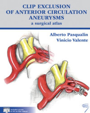Clip exclusion of anterior circulation aneurysms: a surgical atlas. Con Contenuto digitale per download e accesso online Alberto Pasqualin