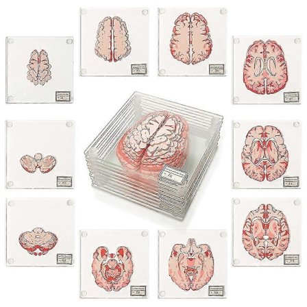 Anatomiset aivoaluset - lahjoja lääketieteen opiskelijoille, aivojen sisustus, lahjoja ihmisen anatomiaan