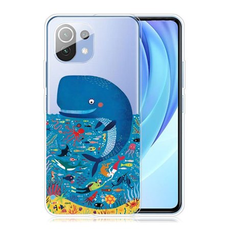 Deco Xiaomi Mi 11 Lite 5G / Xiaomi Mi 11 Lite skal - Blå Val