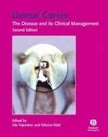Dental Caries: The Disease and Its Clinical Management, ISBN: 9781405138895