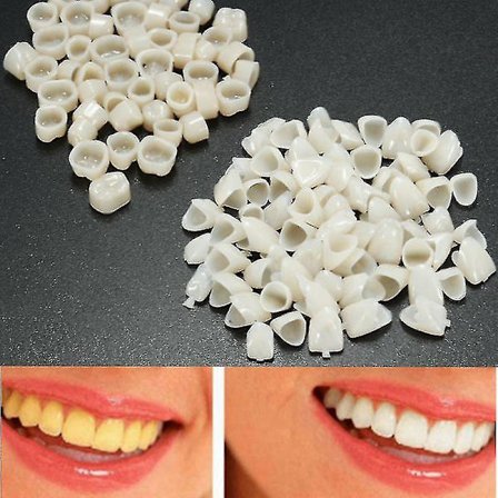 120 st Tandmaterial Tänder Blandade Tillfälliga Kronor 70 st Framtänder 50 st Molar Posterior Veneers Tänder Tandläkarverktyg