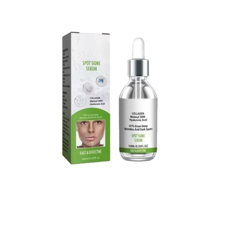 Anti mörk fläck Ta bort fräknar kloasma hyperpigmentering blekning ljus ålder sol Melasma Kloasma Remover Eterisk olja