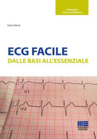 ECG facile Dario Tobruk