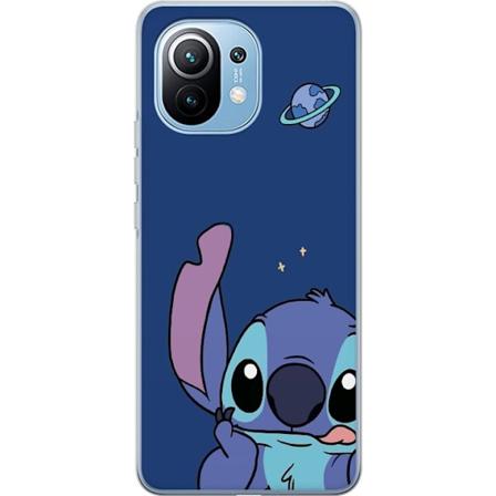 Xiaomi Mi 11 Läpinäkyvä kuori Stitch