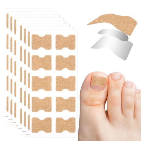 Behandling av nageltrång, 100 st andningsbara korrigeringsplåster, smärtfri nagelkorrigering, nageltrångremsor, behandling av nageltrång