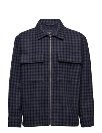 Anf Mens Outerwear Overshirts Monivärinen/Kuvioitu Abercrombie & Fitch