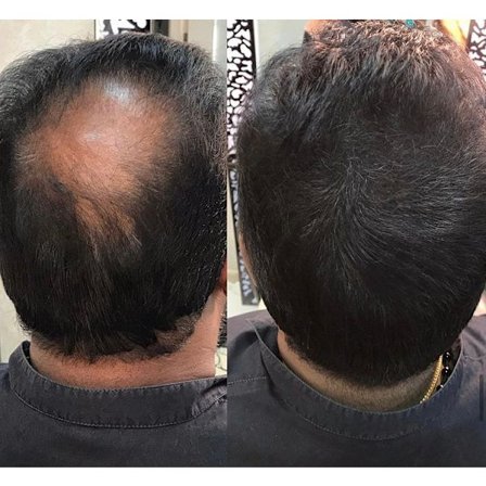 Bunee Large 27,5g - Black - Svart