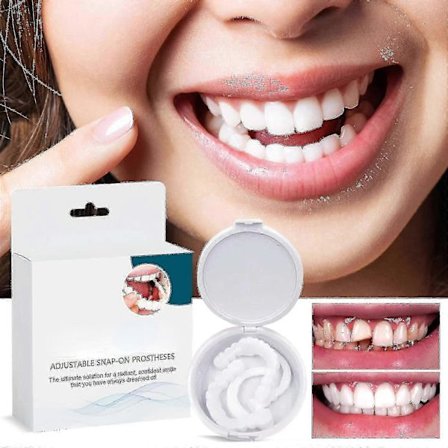 Justerbara Snap On-proteser, Justerbar Snap On-tandprotes, Silikonblekningsproteser, Täcker de imperfekta tänderna