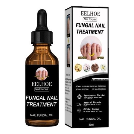 Sopp fingernegl løsning ekstra sterk finger og tånegl sopp terapi ekstra sterk negleforsterker