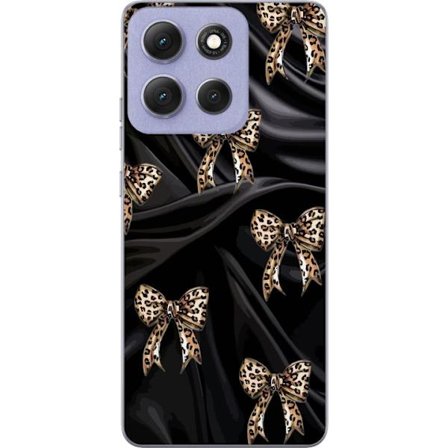 Kompatibelt Mobildeksel til Motorola Moto G86 Power Leopardmønstrede sløyfer på svart silkebakgrunn, luksuriøst mønster med glamour, eksklusiv stil og