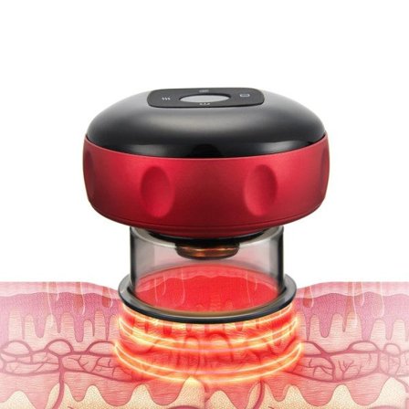 El Vacuum Cupping Massage Kroppskoppar Anti-celluliter Terapi Massör