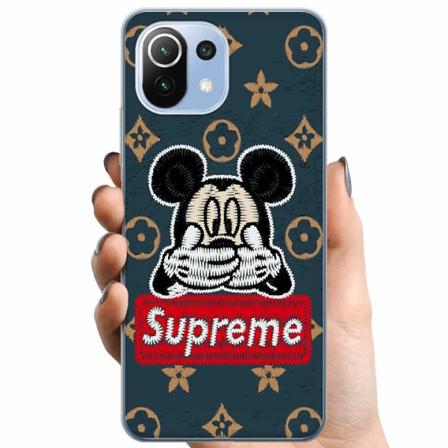 Xiaomi 11 Lite 5g Ne Tpu Mobilskal Happy Sup...