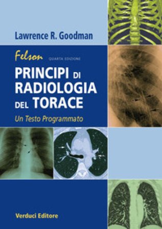 Felson. Principi di radiologia del torace. Un testo programmato Lawrence R. Goodman