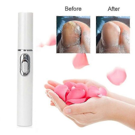 Blå laserpekare mot nagelsvamp, smärtfri nagelvård för onykomykos