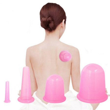 Set med 4 Koppar för Koppingmassage