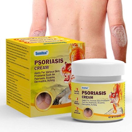 Psoriasisbehandling Kräm, Hud Psoriasis Anti-Klåda Lugnande Kräm, Lugnande & Lugnande Formula Fuktkräm för Rodnad och Obehag