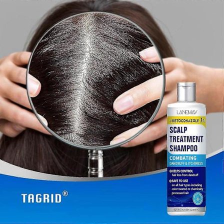 Ketoconazol Hovedbundsbehandlingsshampoo - Anti-skælshampoo - Lindring af kløende hovedbund, Seboroisk dermatitis, Behandling af folliculitis, 