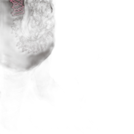 Högmidjade jeans med hål