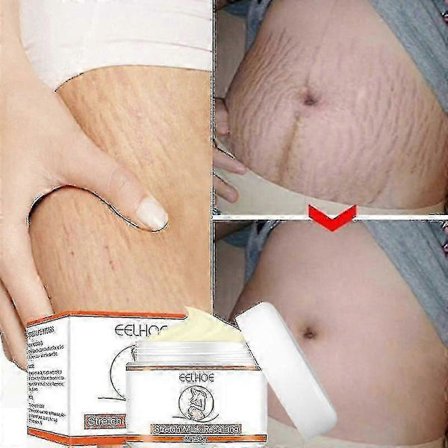 3x Kräm för att ta bort bristningar Fett Tillväxt Ränder Mammarskapsärr Akne Reparation Öka Hudens Elasticitet Anti-rynkor Fast Kroppsvård