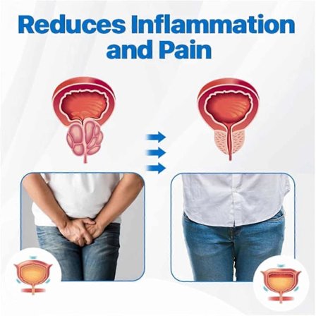 Prostapower, Prostapower Magnetisk Kobberarmbånd, Prosta Power Magnetisk Kobberarmbånd
