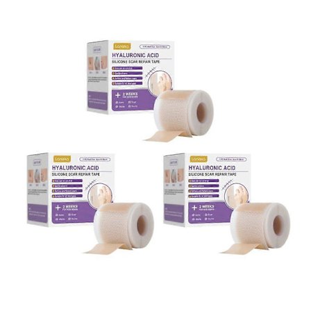 Arvævstape Rulle Til Kirurgiske Ar Selvklæbende Tape Terapi Patch Forbrænding Akne Hudpleje Silikone Arvævsplastre, Silikone Arvævstape